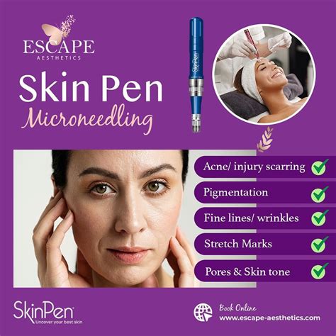 Laser Genesis: Procedure, Cost, and What to Expect .